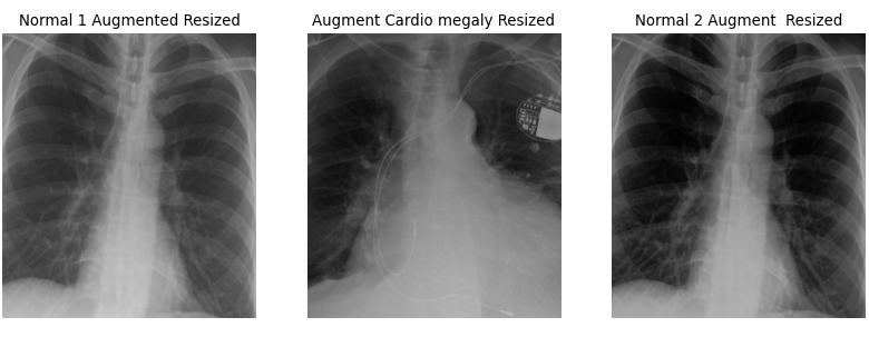 augmented chest x-ray