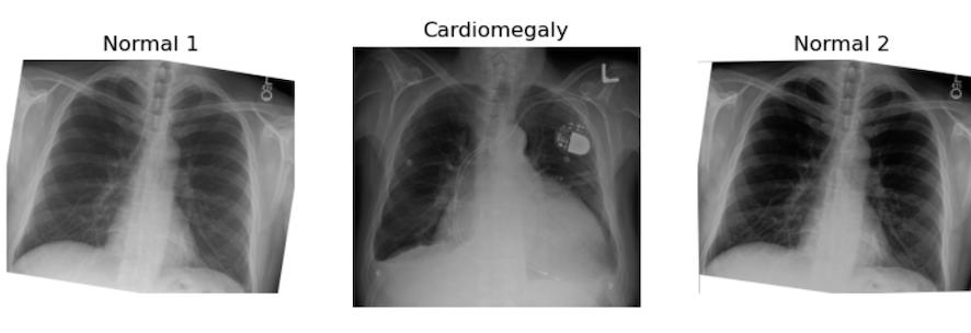 CXR examples