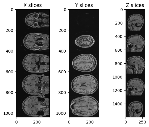 Multiple slices example.