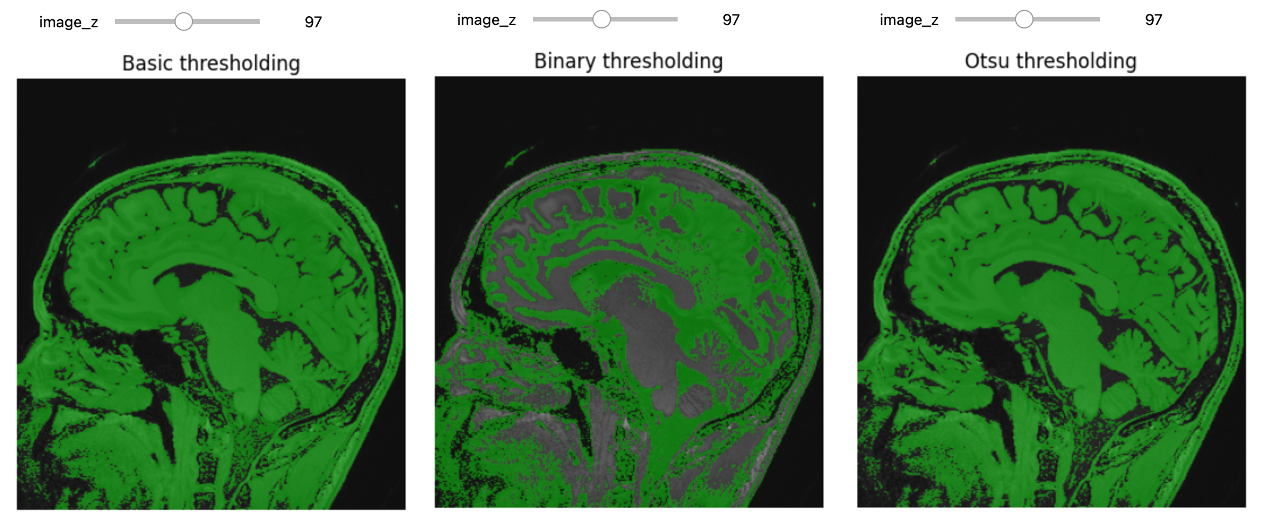 Basic thresholding methods.