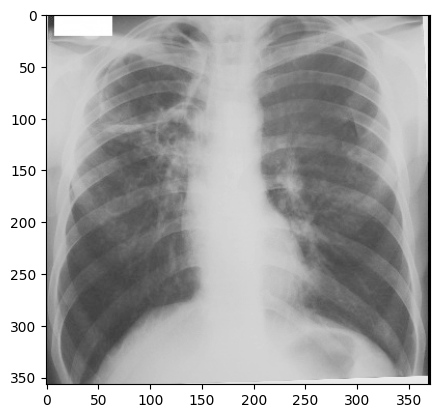 Grayscale x-ray image.