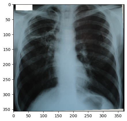 Digital x-ray image.