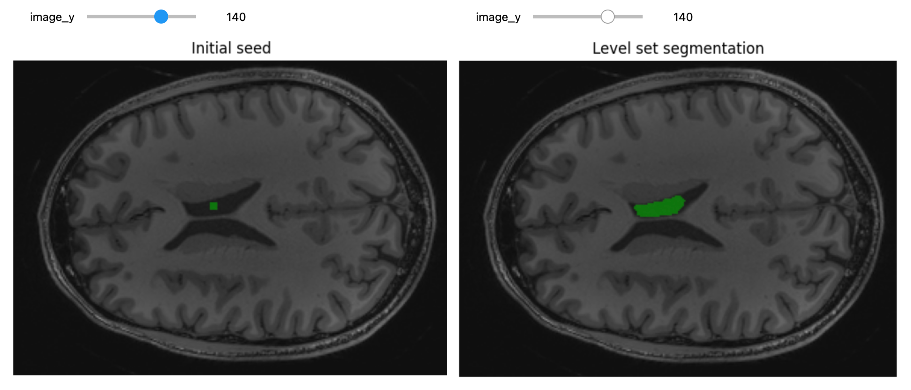 Y-axis segmentation.